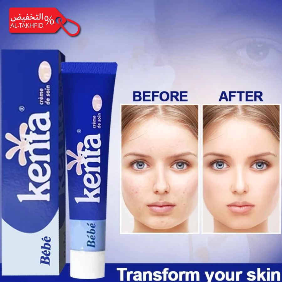 Kenta baby cream packaging with 'Before' and 'After' skin transformation images on a blue background.