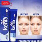 Kenta baby cream packaging with 'Before' and 'After' skin transformation images on a blue background.